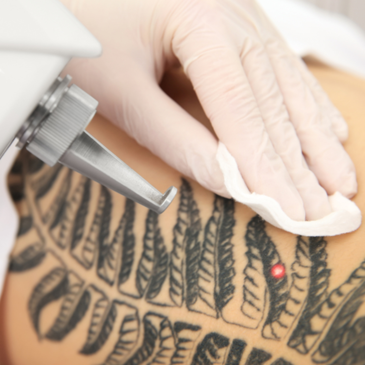 CLOUD AESTHETICS - Tattoo Removal en PMU